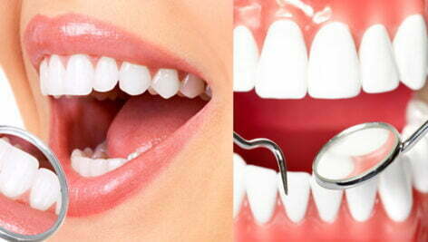 تصاویر با کیفیت دندانپزشکی Stomatology