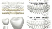 دانلود وکتور المان های داندانپزشکی، دندان و ایمپلنت دندان Dental Implant Illustration